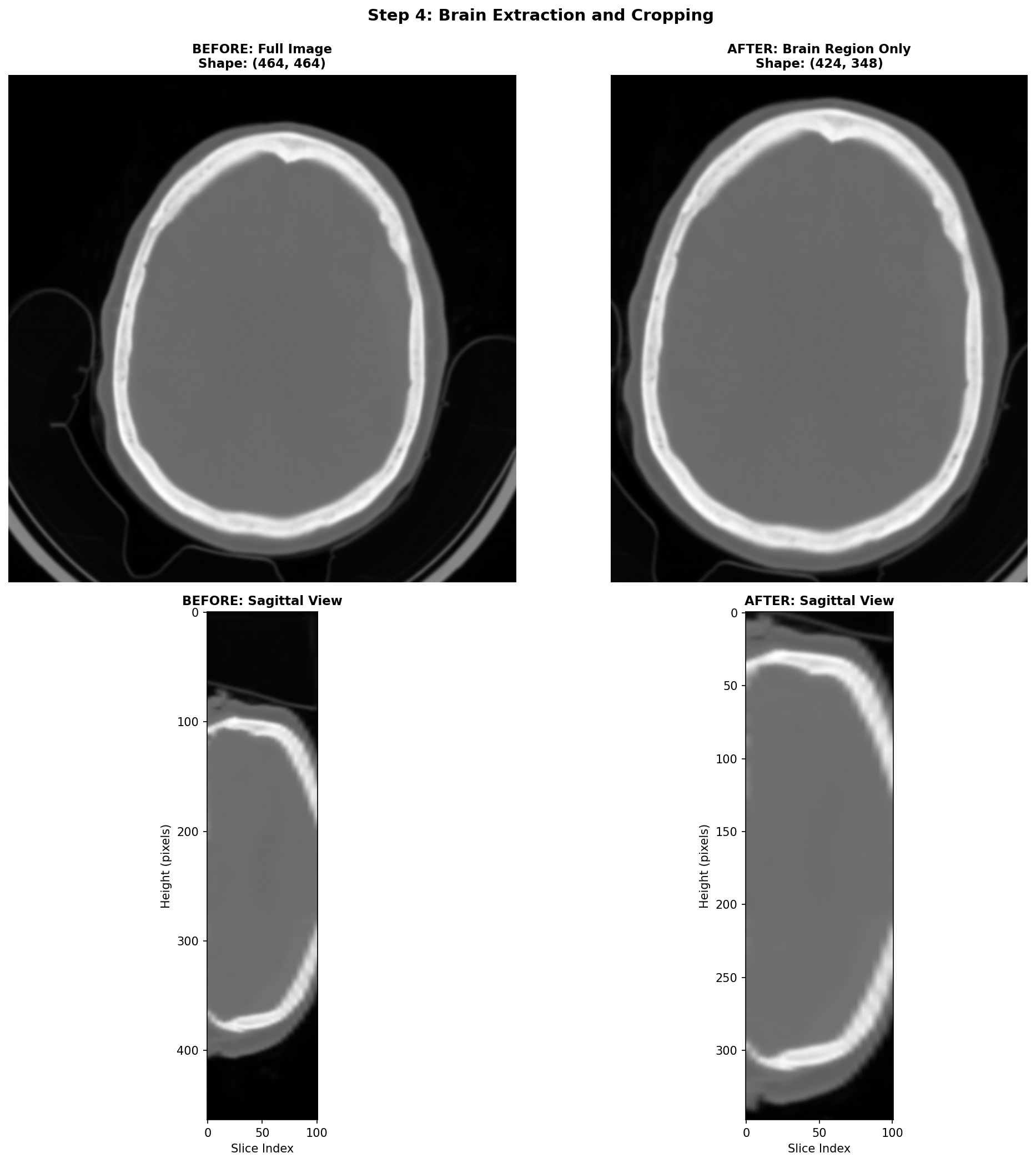 Brain Extraction and Cropping