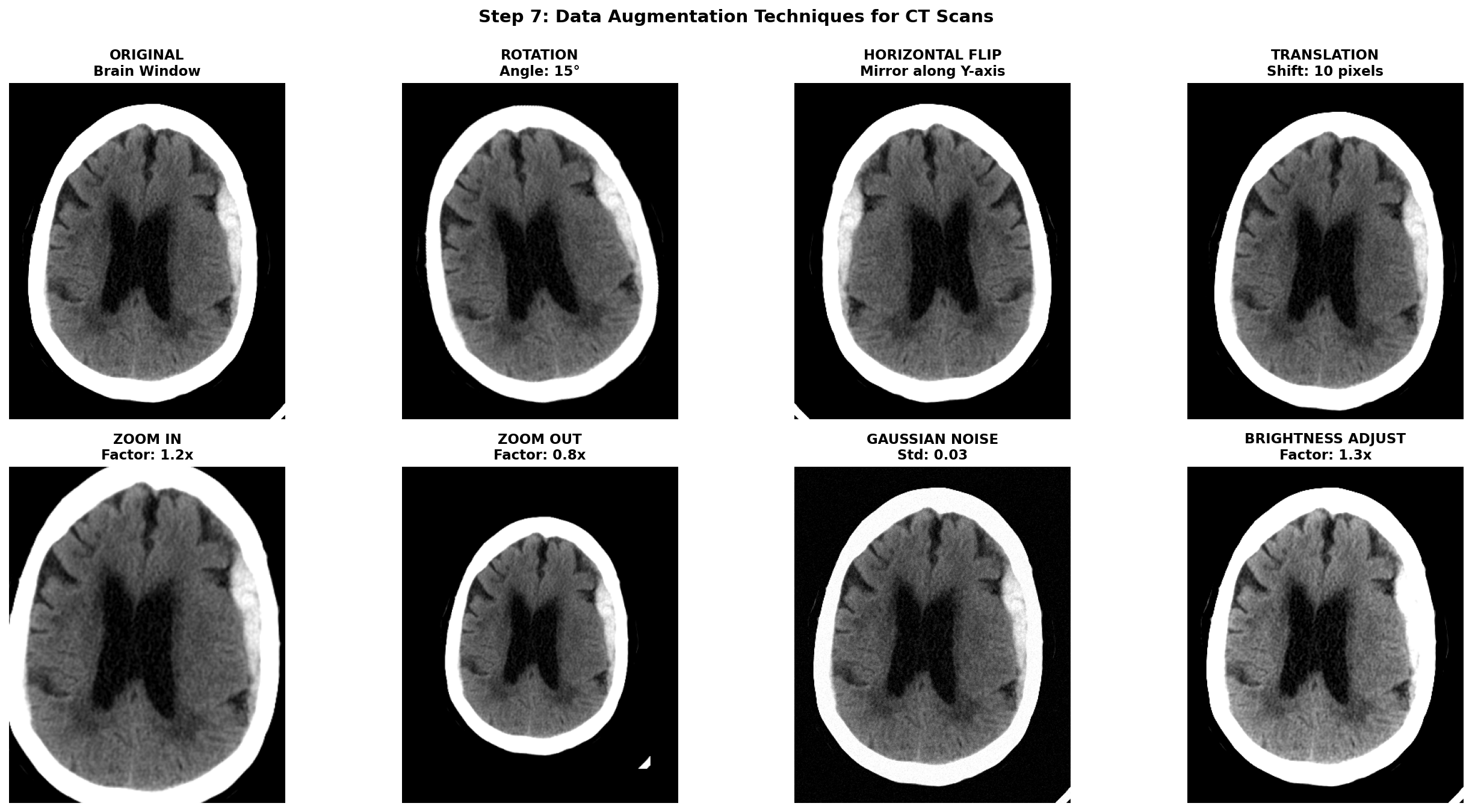 Augmentation Examples