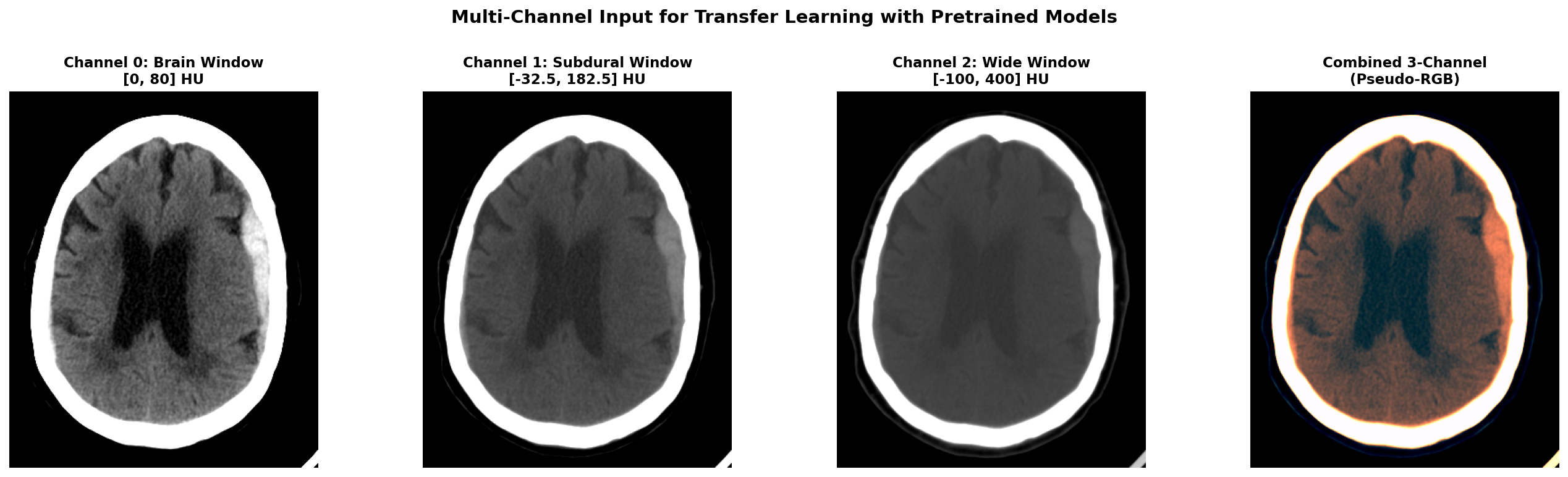 Multi-channel windowing for transfer learning